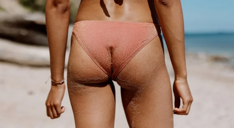 Tips for Treating and Preventing Butt Acne