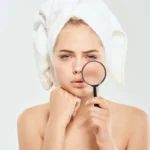 Banishing Blemishes: Tips for Reducing Dark Spots on Your Face