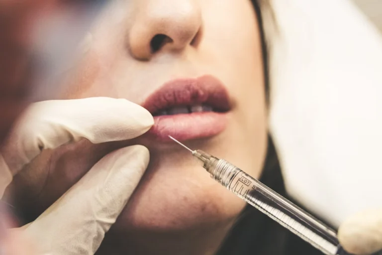 Tips On How To Responsibly Use Botox On Your Face